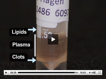 ELISA method 2