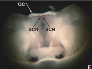Dissecting the suprachiasmatic nucleus from the hypothalamus. Click the image to watch the JoVE video used by Dr. Casey and her colleagues, Slice Preparation, Organotypic Tissue Culturing and Luciferase Recording of Clock Gene Activity in the Suprachiasmatic Nucleus.