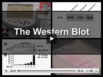 The Western Blot Video Demonstration