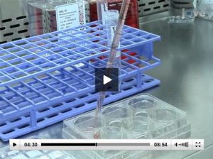 Cell culture experiment from the Brugge Lab